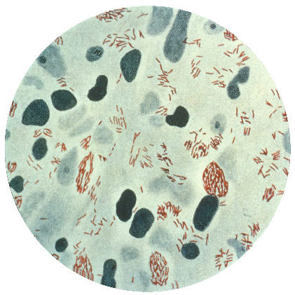 Mycobacterium leprae bacteria 