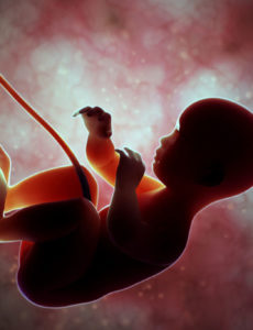 There is no reliable historical evidence that abortion was ever considered a constitutional right. It should go without saying that every unborn baby has value, no matter the stage or circumstances
