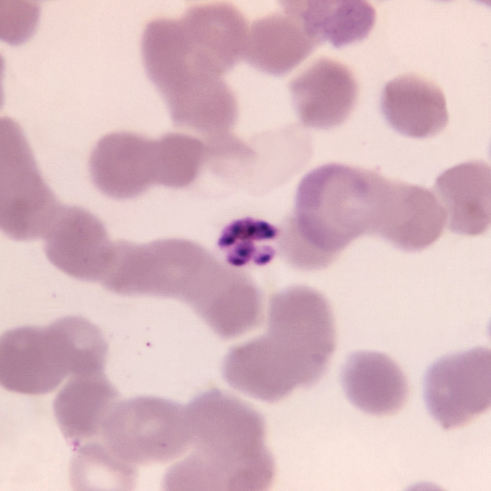 Plasmodium malariae schizont
